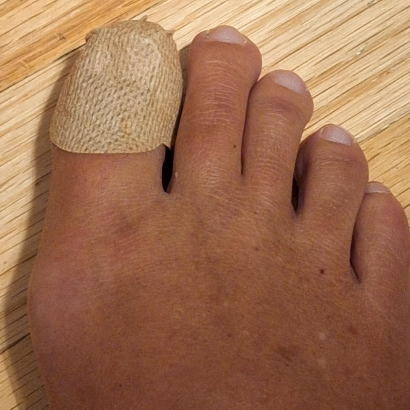 Fungal Nail Renewal Patches